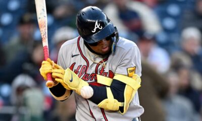 Acuña regresa a la alineación de Bravos un día después de recibir un bolazo en la mano